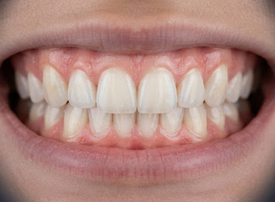 smile img